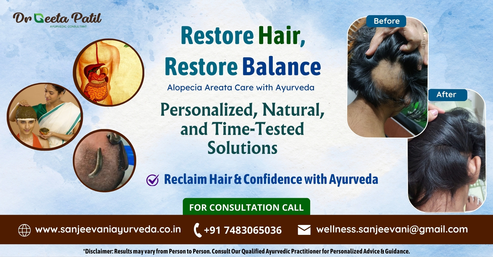 Ayurvedic consultation for alopecia jp nagar bangalore